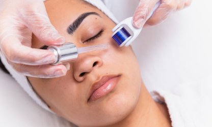 Microneedling - Medgel